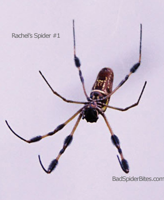 Spider 1 by Rachel
