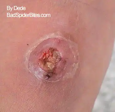 Staph infection on Dede photo 4 of 5.